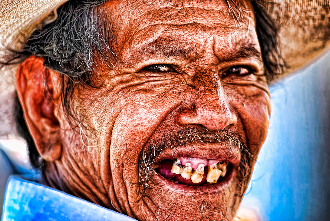 гниющие зубы фото